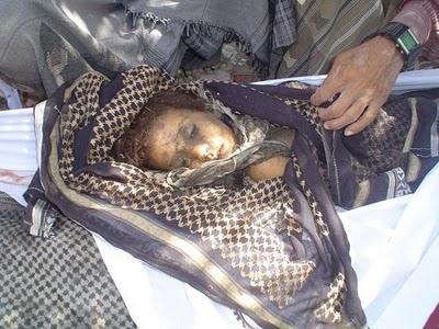 Amnesty Internasional: Rudal Amerika Bantai Wanita dan Bocah di Yaman