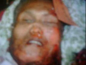 Kepala Bomber JW. Marriot Beredar di Email dan Blackberry 