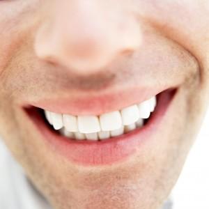 Cara Mudah Mengurangi Noda Pada Gigi