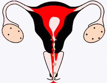 Sensitifnya Perempuan Saat Akan Menstruasi