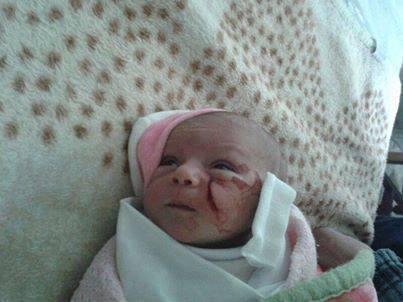 FOTO: Bayi Perempuan Korban Serangan Udara Tentara Bashar Asad