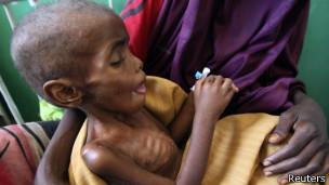 Bencana Kelaparan di Somalia 260.000 Tewas