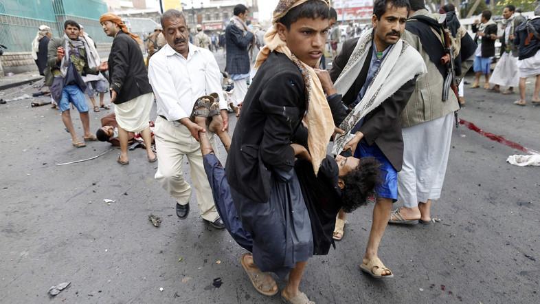 Bom Mobil Menewaskan 50 Milisi Syiah di Yaman
