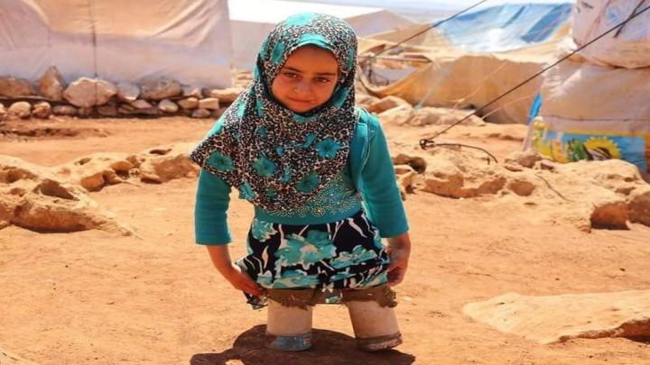 Gadis Suriah Delapan Tahun yang Menggunakan Kaleng Tuna untuk Berjalan Terima Kaki Palsu