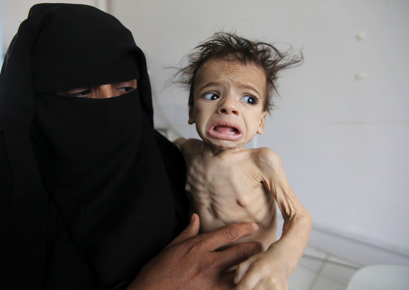 WFP: Pemberontak Syi'ah Houtsi Curi Makanan 'dari Mulut' Orang-orang Yaman yang Kelaparan