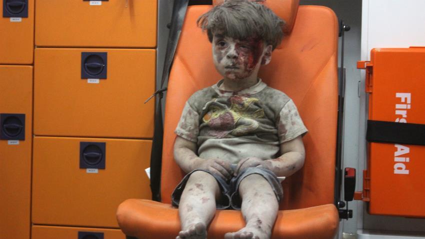 Meski Bukti Kuat, Rusia Tetap Bantah Bombardir Rumah Bocah Suriah Omran Daqneesh