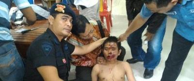 MS Ka'ban Harap Pelaku Bom di Medan Tidak Mati sebelum Diinterogasi dan Diadili