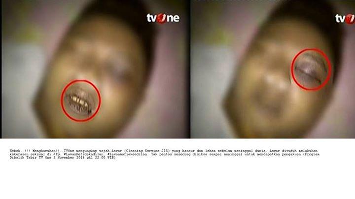 Keadilan Untuk OB JIS: Wajah Azwar Hancur, Penuh Lebam...