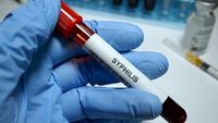 Kasus Sifilis di Indonesia Semakin Tinggi, Bukti Rusaknya Generas
